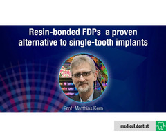 Resin-bonded FDP’s – a proven alternative to single-tooth implants (Webinar, On-demand)