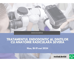 Tratamentul endodontic al dintilor cu anatomie radiculara severa (Nisa, 18-19 mai 2024)