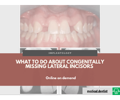 What to Do About Congenitally Missing Lateral Incisors (Online la cerere)