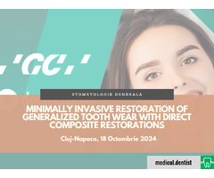Minimally invasive restoration of generalized tooth wear with  .. (Cluj-Napoca, 18 Octombrie 2024)